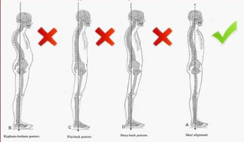 Posture Correction - Waverley Physiotherapy